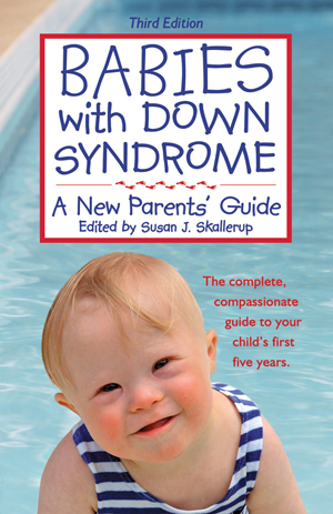 Babies with Down Syndrome